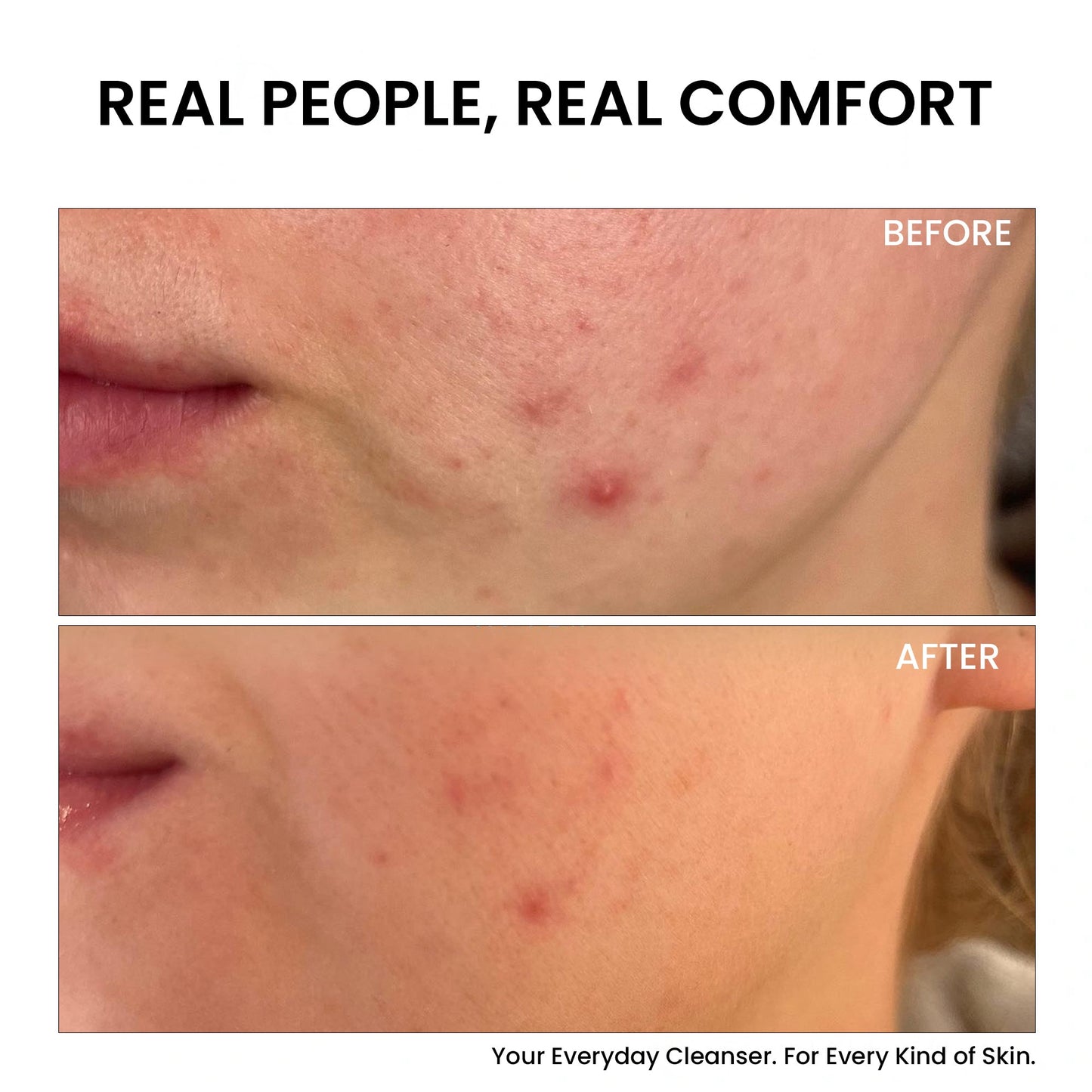 Skinovate Gentle Cleanser